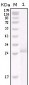 HER-2 Antibody